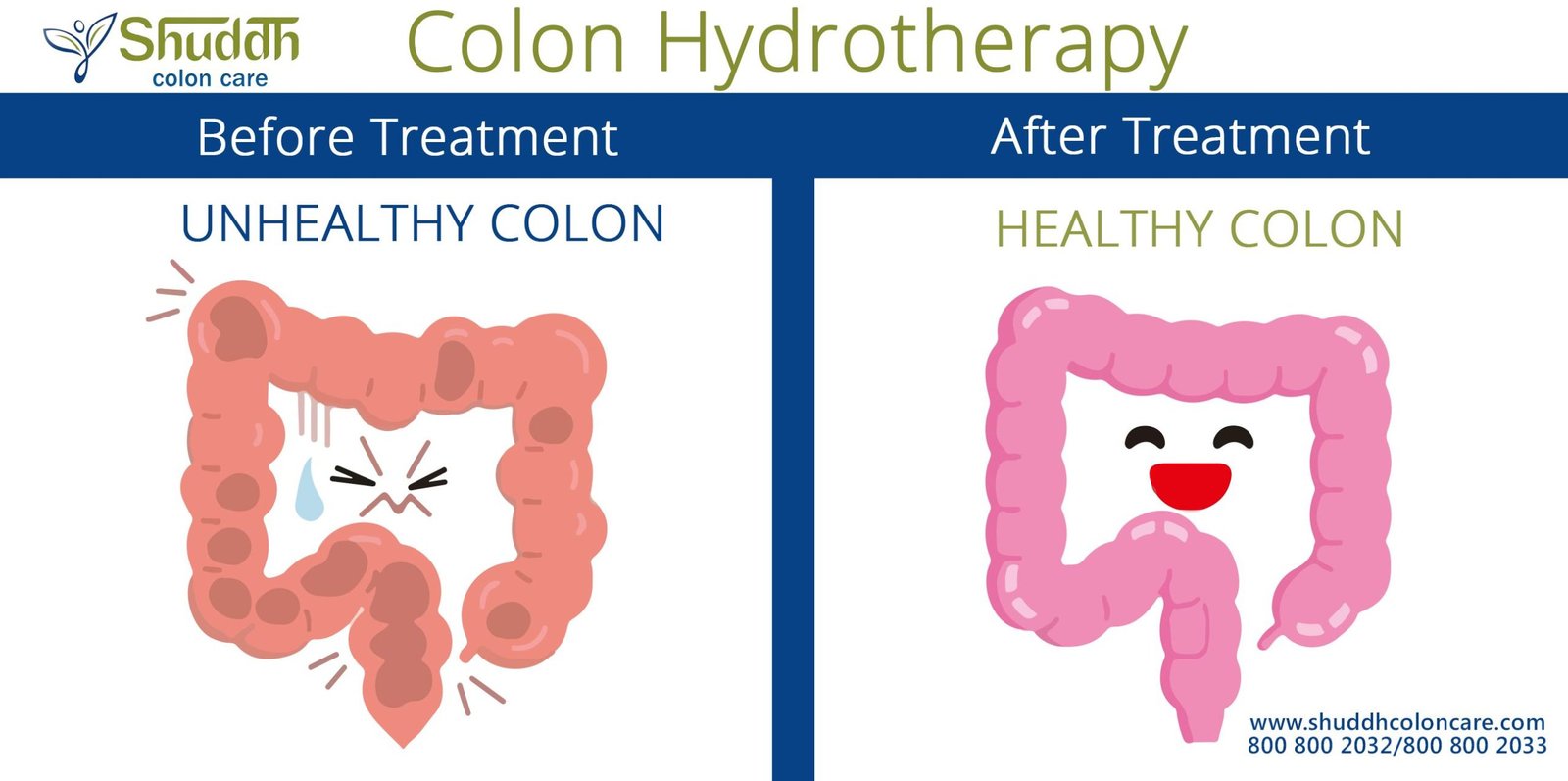 What’s the Best Way to Clean Out Your Colon?