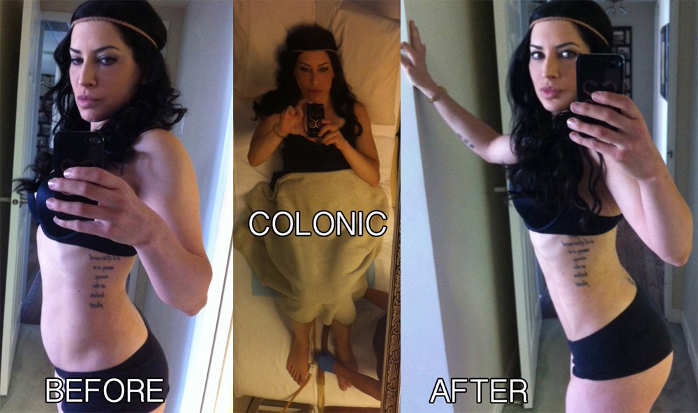 How to Colon Cleanse at Home