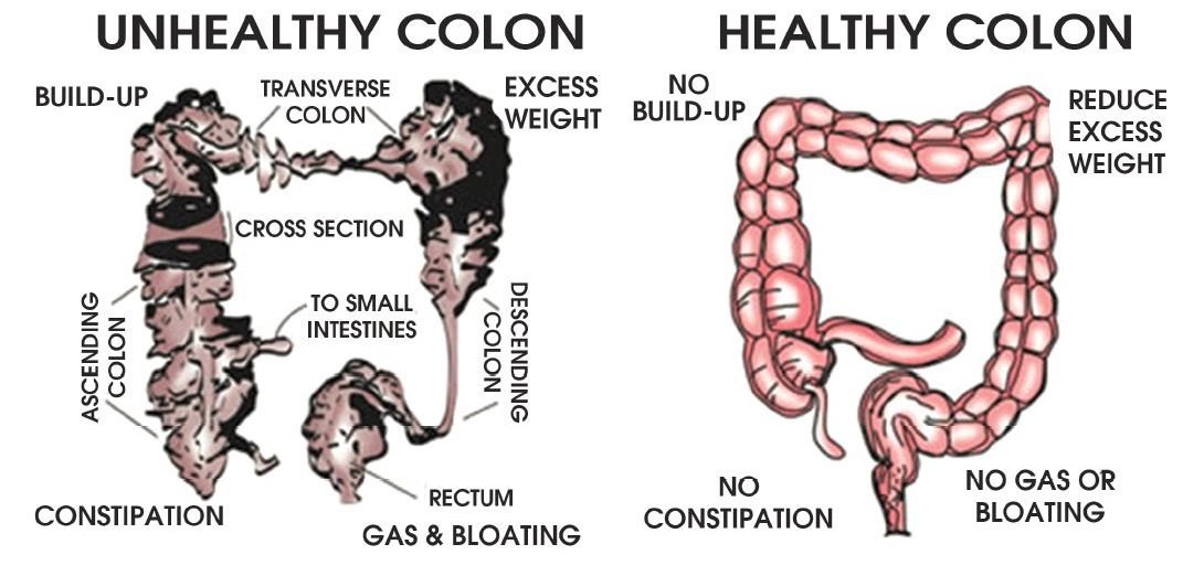 Colonic Machine 201